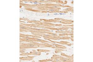 Immunohistochemical analysis of paraffin-embedded human heart tissue using (ABIN6244160 and ABIN6578849) performed on the Leica® BOND RXm.