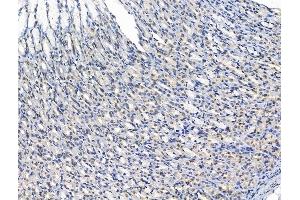 ABIN7094764 and ABIN7098815 at 1/100 staining Rat stomach tissue by IHC-P. (ADCY10 anticorps  (N-Term))