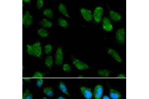 Immunofluorescence analysis of MCF-7 cells using IL1RN Polyclonal Antibody (IL1RN anticorps)