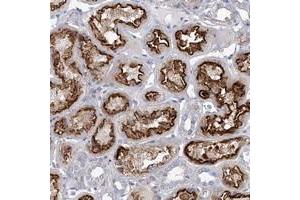 Immunohistochemical staining of human kidney with FLJ22374 polyclonal antibody  shows strong luminal membrane and additional cytoplasmic positivity in renal tubules. (FAM188B anticorps)