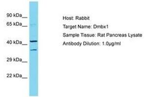 Image no. 1 for anti-Diencephalon/mesencephalon Homeobox 1 (DMBX1) (AA 191-240) antibody (ABIN6750283) (DMBX1 anticorps  (AA 191-240))