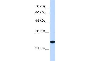 WB Suggested Anti-TMEM109 Antibody Titration:  1. (TMEM109 anticorps  (Middle Region))
