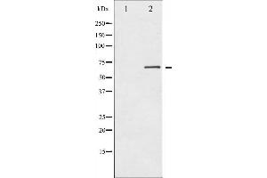 Western blot analysis of PKR expression in Starvation treated K562 whole cell lysates,The lane on the left is treated with the antigen-specific peptide. (EIF2AK2 anticorps  (Internal Region))