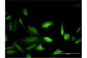 Immunofluorescence of monoclonal antibody to MAPK9 on HeLa cell.
