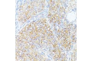Immunohistochemistry of paraffin-embedded rat ovary using SLC7 antibody (ABIN7270481) at dilution of 1:100 (40x lens). (SLC7A2 anticorps  (C-Term))