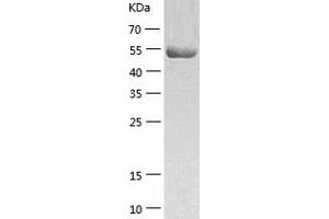 Western Blotting (WB) image for Thioredoxin Reductase 1 (TXNRD1) (AA 2-499) protein (His-IF2DI Tag) (ABIN7125363)