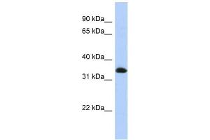 Western Blotting (WB) image for anti-Zinc Finger Protein 511 (ZNF511) antibody (ABIN2458281) (ZNF511 anticorps)