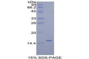 SDS-PAGE analysis of Human Golgi Glycoprotein 1 Protein. (GLG1 Protéine)
