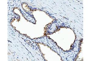 IHC analysis of BI-1/TMBIM6 using anti-BI-1/TMBIM6 antibody (ABIN7603199).