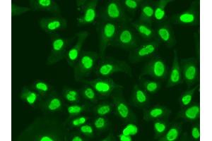 Immunofluorescence analysis of A549 cells using RFC1 antibody.