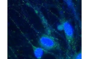 Expression of HCN2 in rat DRG primary culture - Immunocytochemical staining of paraformaldehyde-fixed and permeabilized rat dorsal root ganglion (DRG) primary culture using Anti-HCN2 Antibody (ABIN7043279, ABIN7044940 and ABIN7044941), (1:100), (green).