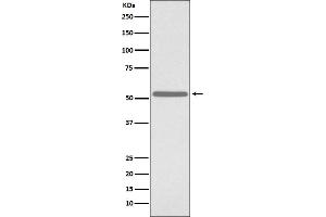 Western blot analysis of Cdc25C expression in K562 cell lysate.
