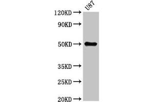 Western Blot Positive WB detected in: U87 whole cell lysate All lanes: URI1 antibody at 5. (URI1 anticorps  (AA 180-298))