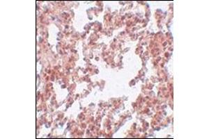 Immunohistochemistry of SRPX2 in rat lung tissue with this product at 5 μg/ml. (SRPX2 anticorps  (N-Term))