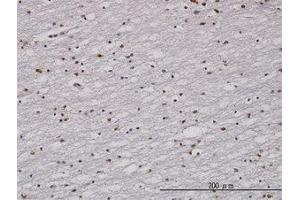Image no. 1 for anti-Cell Cycle Checkpoint Protein RAD1 (RAD1) (AA 1-90) antibody (ABIN598565) (RAD1 anticorps  (AA 1-90))
