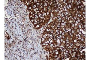 Image no. 4 for anti-SERPINE1 mRNA Binding Protein 1 (SERBP1) (AA 1-262) antibody (ABIN1490675)