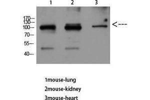 Western Blot (WB) analysis of Mouse Lung Mouse Kidney Mouse Heart using VE-Cadherin Polyclonal Antibody diluted at 1:500. (Cadherin 5 anticorps  (Internal Region))