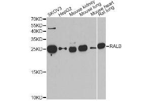 Western blot analysis of extracts of various cell lines, using RALB antibody. (RALB anticorps  (AA 1-206))