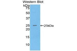 Detection of Recombinant SPRY3, Human using Polyclonal Antibody to Sprouty Homolog 3 (SPRY3)