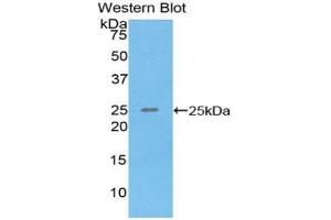 Detection of Recombinant SPRY3, Human using Polyclonal Antibody to Sprouty Homolog 3 (SPRY3) (SPRY3 anticorps  (AA 91-288))