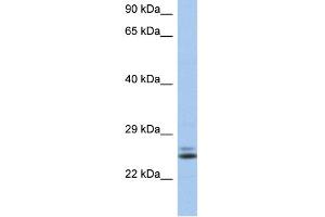 WB Suggested Anti-RAB15 Antibody Titration: 0.