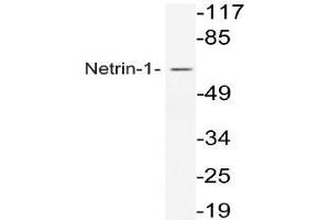 Western blot analysis of Netrin-1 antibody in extracts from COS7 cells. (Netrin 1 anticorps)