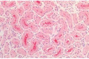 Immunohistochemistry analysis using Rabbit Anti-Tau Polyclonal Antibody (ABIN6698774).
