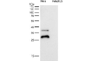 All lanes use the Antibody at 1:1K dilution for 1 hour at room temperature.