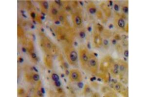 Used in DAB staining on fromalin fixed paraffin-embedded Liver tissue (TGFBI anticorps  (AA 423-632))