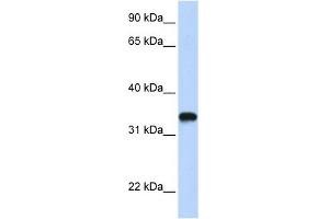 HAS3 antibody used at 1 ug/ml to detect target protein. (HAS3 anticorps  (C-Term))