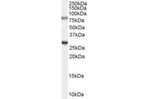 ABIN185715 (0. (SV2A anticorps  (Internal Region))