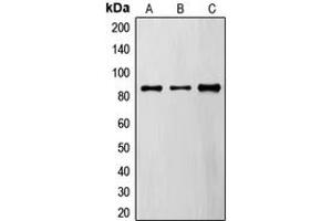Western blot analysis of FYB expression in A549 (A), MDAMB435 (B), TF1 (C) whole cell lysates. (FYB anticorps  (C-Term))