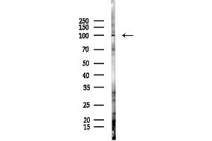 Western blot analysis of lysates from Hela cells(starvation 24h treatment), using DSC1 Antibody at 1/1000 dilution.