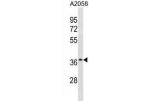 Western Blotting (WB) image for anti-Olfactory Receptor, Family 52, Subfamily J, Member 3 (OR52J3) antibody (ABIN3001032) (OR52J3 anticorps)