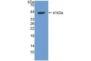 Detection of Recombinant TPS, Human using Polyclonal Antibody to Tryptase (TPS)
