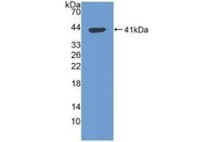Detection of Recombinant TPS, Human using Polyclonal Antibody to Tryptase (TPS) (TPSAB1 anticorps  (AA 161-262))