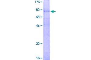 Frizzled Family Receptor 4 (FZD4) (AA 1-537) protein (GST tag)