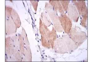Immunohistochemical analysis of paraffin-embedded muscle tissues using IL1B mouse mAb with DAB staining. (IL-1 beta anticorps)