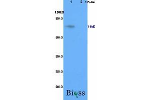 L1 rat brain, L2 rat liver lysates probed (ABIN708101) at 1:200 in 4 °C.