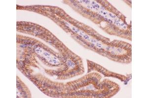 IHC-P: alpha Catenin antibody testing of mouse intestine tissue (CTNNA1 anticorps  (AA 143-292))