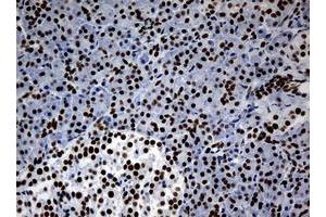 Image no. 3 for anti-Nibrin (NBN) (AA 461-754) antibody (ABIN1491540)