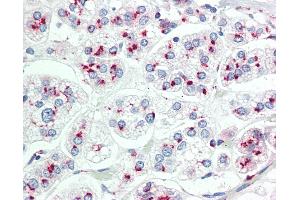 Anti-LIMD1 antibody IHC staining of human adrenal.