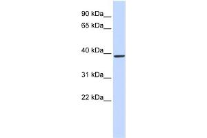 WB Suggested Anti-QPCT Antibody Titration:  0. (QPCT anticorps  (Middle Region))
