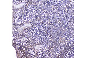 IHC analysis of BCMA using anti-BCMA antibody .