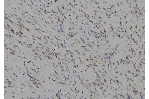 ABIN6277264 at 1/100 staining Human gastric tissue by IHC-P. (MMP14 anticorps  (C-Term))