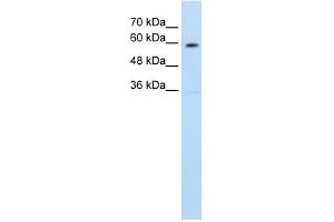 SLC11A1 antibody used at 1. (SLC11A1 anticorps  (C-Term))