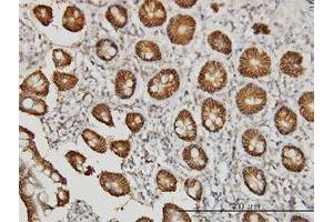 Immunoperoxidase of monoclonal antibody to CLDN1 on formalin-fixed paraffin-embedded human small Intestine.
