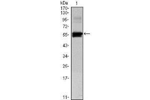 Western Blot showing PAX6 antibody used against human PAX6 (AA: 1-223) recombinant protein. (PAX6 anticorps)
