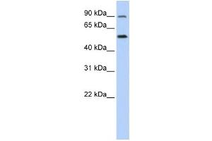 Western Blotting (WB) image for anti-Solute Carrier Family 41, Member 1 (SLC41A1) antibody (ABIN2458818) (SLC41A1 anticorps)