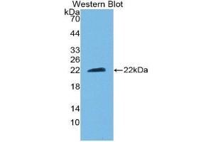 Western Blotting (WB) image for anti-Ciliary Neurotrophic Factor (CNTF) (AA 2-198) antibody (ABIN3209714) (CNTF anticorps  (AA 2-198))